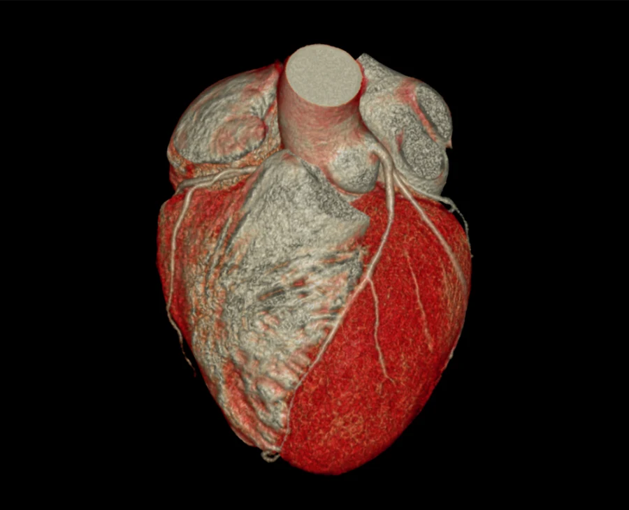 CTA Cardiac Scanning