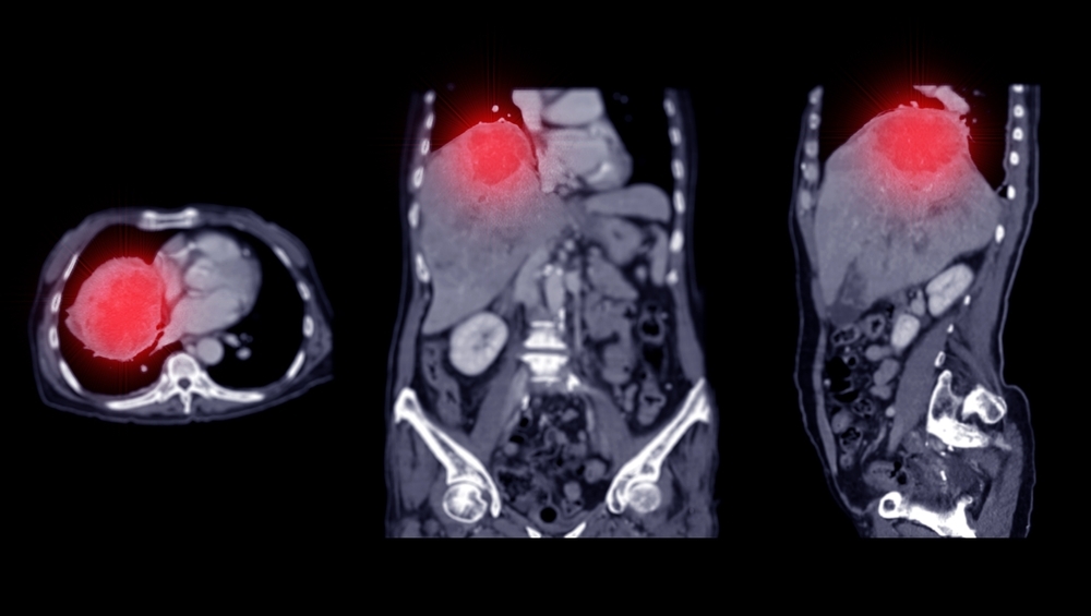 CT Whole Body Scanning